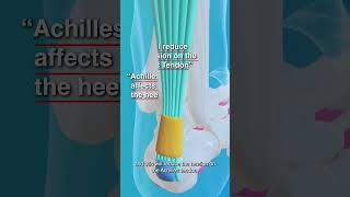 Why Stretching Your Calf Muscles Matters For Achilles Tendinopathy [upl. by Eelanna]