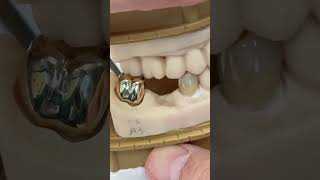 Zirconia vs 14 kt gold EnvisiontecMain envisiontec [upl. by Orecul]