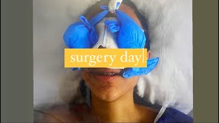 surgery day  ethnic rhinoplasty with dr samil sahin  part 2 [upl. by Refitsirhc5]