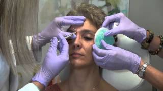 What is Botox and How Does it Work [upl. by Ahsikyt]