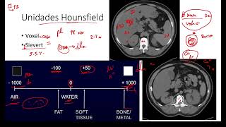 Unidades Hounsfield Densidad Tomografia [upl. by Annad]