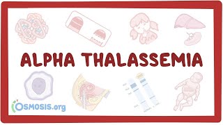 Alphathalassemia  an Osmosis Preview [upl. by Lemaceon]