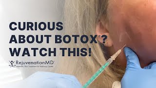 Typical Botox Injections for Master Muscles Glabella and Forehead [upl. by Adnaw]