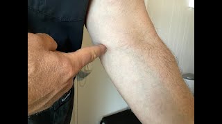 Golfers Elbow vs Tennis Elbow Easy tip on remembering [upl. by Redliw]