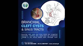 Branchial Cleft Cysts and Sinus treatment HealthcareInnovation BranchialCleftCysts SinusTreatment [upl. by Wendi205]