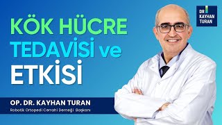 Diz Kireçlenmesi Tedavisi İçin Kök Hücre Tedavisi Ne Kadar Etkilidir I Op Dr Kayhan Turan [upl. by Cadman]