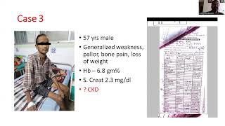 Hypercalcemia Case Based Approach Dr Sumit Chakraborty [upl. by Wesla382]