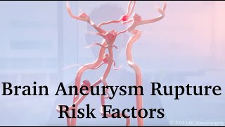 Brain Aneurysm Rupture Risk Factors  UNC Neurosurgery [upl. by Odnalro]