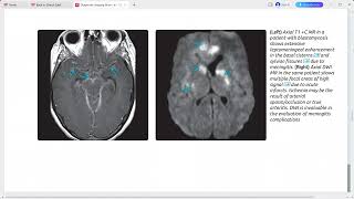 ultrasound radiologysonology [upl. by Sutherland]