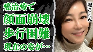 堀ちえみが背中を開きボルトを埋め込んだ手術の結果”歩行困難”に…別の手術で顔面崩壊したがん闘病中の現在の姿に涙が止まらない！夫と”離婚間近”まで発展でヤバい【芸能】 [upl. by Donaghue597]