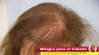 solucion para la caida del cabello  Cómo estimular el cuero cabelludo para hacer crecer el pelo [upl. by Elay]