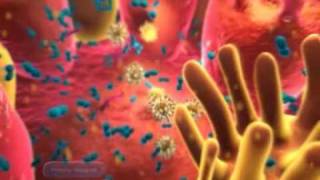 VIB animation Crohns disease [upl. by Imoin]