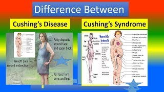 Difference Between Cushing’s Disease and Cushing’s Syndrome [upl. by Ludba]