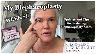 Blepharoplasty Update Week 5 Scars Recovery Bruising Update Eyelid Surgery CO2 Laser amp Scar Gel [upl. by Niwroc]