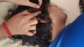 ASMR  Real Person Scalp Check and Treatment [upl. by Anna]