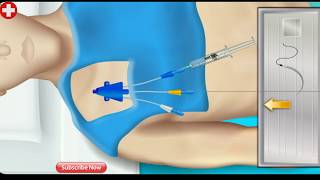 Cvp central line easy waycentral line animated video [upl. by Aillicsirp]