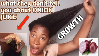 BLACK GIRL use ONION JUICE for 14 days amp this happened 😲 ONION JUICE FOR HAIR GROWTH before after [upl. by Abbotsun809]