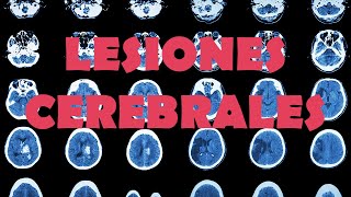 PSICOLOGÍA PARA EL DÍA A DÍA Lesiones cerebrales [upl. by Ephram]