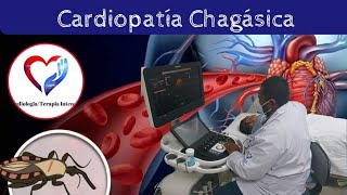 CardiopatÍa chagásica [upl. by Dwyer423]