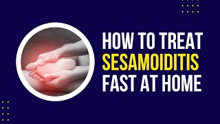 Sesamoiditis Treatment What Can I Do at Home [upl. by Burt845]