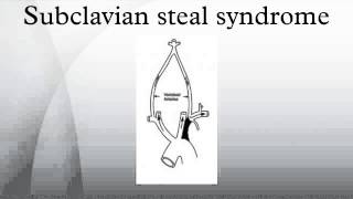 Subclavian steal syndrome [upl. by Frasch900]