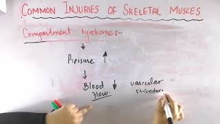 Compartment syndrome  Common injuries of skeletal muscle  Biomechanics of skeletal muscle [upl. by Yht]