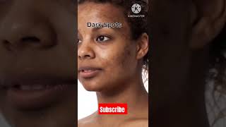 Cream for Dark spots pigmentation blemishes uneven skintone tanning [upl. by Allen423]