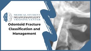 Odontoid Fracture Classification and Management [upl. by Tortosa]