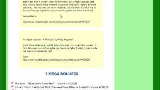 How To Cure Hemorrhoids in 48 Hours  Full Review  HMiracle [upl. by Leahcimluap709]