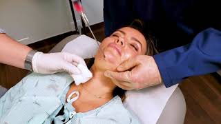 In Office Chin Liposuction [upl. by Aeneas]