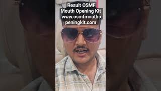 osmfmouthopeningkit Results PK got mouth opening 3 fingers in just 4 months used only 2 kits [upl. by Leverick390]