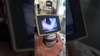 Video laryngoscopy [upl. by Koblick]