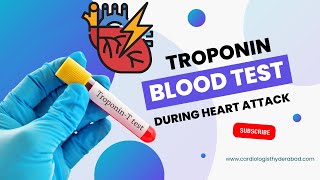 Troponin test for heart attack  Troponin I and Troponin T  Cardiac troponins  Trop t  Trop i [upl. by Asilrahc]