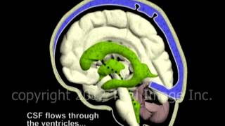 Hydrocephalus and Cerebrospinal Fluid CSF circulation by Dr Cal Shipley MD [upl. by Kegan362]