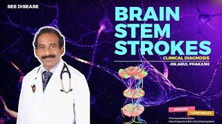 BRAIN STEM STROKES  Diagnosis and Localization  NEUROLOGY [upl. by Ettenav]