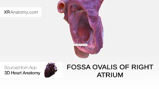 Fossa ovalis of right atrium [upl. by Adnal663]