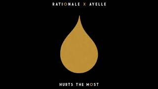 Rationale amp Ayelle  Hurts the Most Audio [upl. by Chloette]