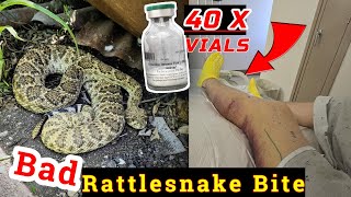 Rattlesnake Bite While Herping Central Texas [upl. by Ahsok]