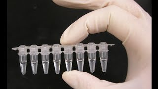 PCR optimization  PCR technique [upl. by Nilat]