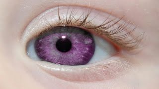 The World’s Rarest Eye Colors [upl. by Turrell]