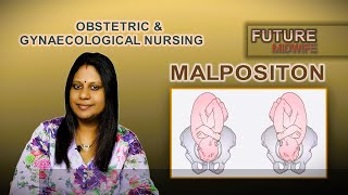 FETAL MALPOSITIONDHANYA DEEPUHIGH RISK LABOUR [upl. by Iba862]