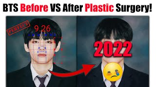 BTS Members Before Plastic Surgery VS After Plastic Surgery 2022 That Fans Should See [upl. by Anaehs375]