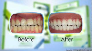 Natural teeth whitening system by Meodentalnow in Australia and NZ [upl. by Duile219]