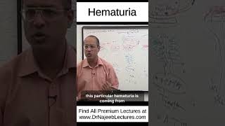 Hematuria shortvideo shorts drnajeeb drnajeeblectures [upl. by Enyrhtak]