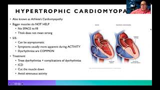 Complex Cardiomyopathies [upl. by Hiller519]