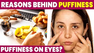 Poor Diet causes Eye Puffiness  Puffy Eyes Home Remedies [upl. by Kenward310]