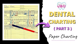 PAPER CHARTING FOR DENTAL ASSISTANTS  PART 3  Paper charting [upl. by Okechuku]