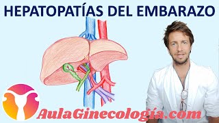 HEPATOPATÍAS del EMBARAZO colestasis preeclampsia víricas hemangiomas Ginecología y Obstetricia [upl. by Yeldnarb572]