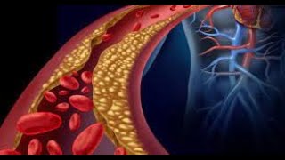 Foods To Lower Your Bad Cholesterol LDL [upl. by Rexford117]