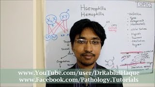 Haemophilia  Definition Types Pathogenesis Clinical Features Diagnosis Treatment  HD [upl. by Ytisahcal903]